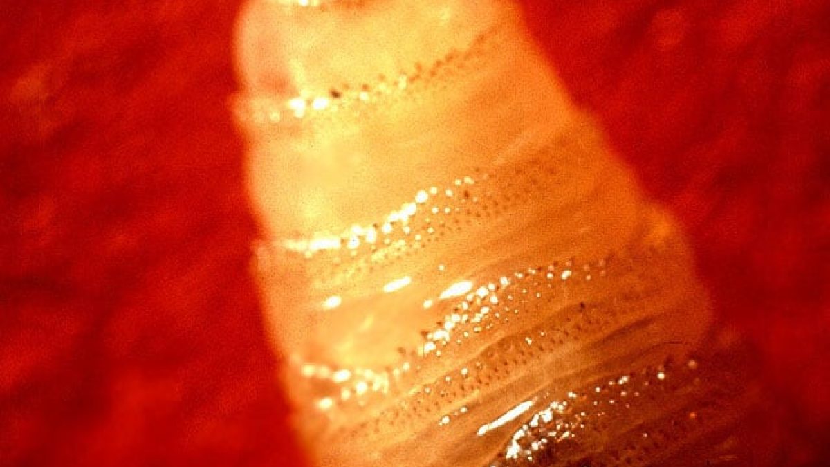 Verme comedor de carne reaparece no Texas após erradicação