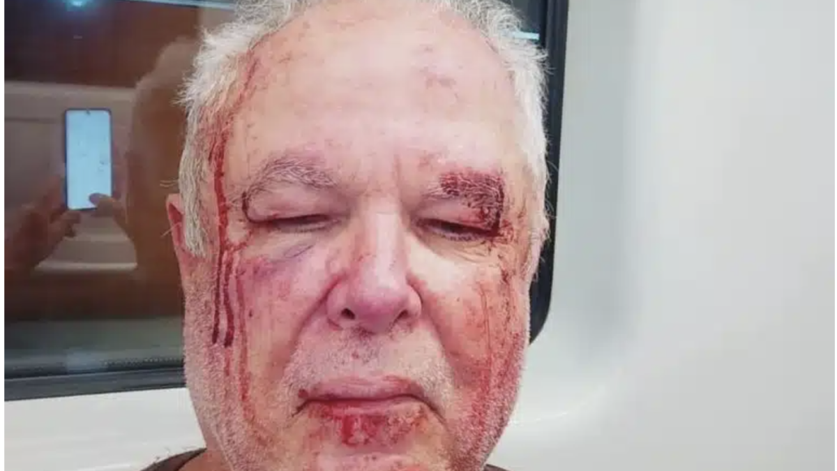 Petista de 69 anos é agredido em Copacabana por motivação política; bancada do PT cobra apuração