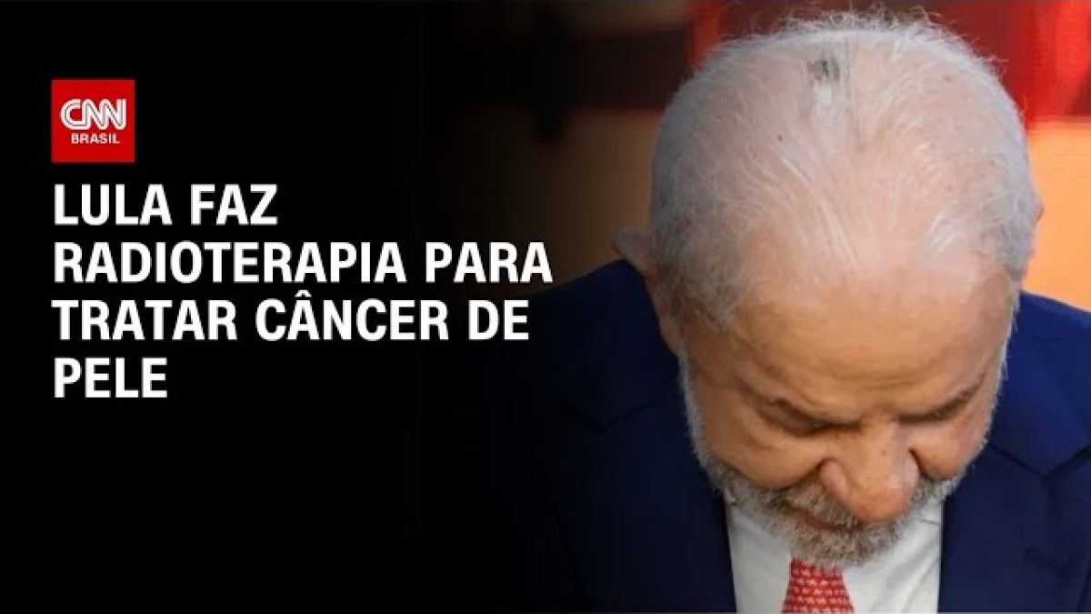 Lula anuncia fim de radioterapia após câncer de pele e se diz curado