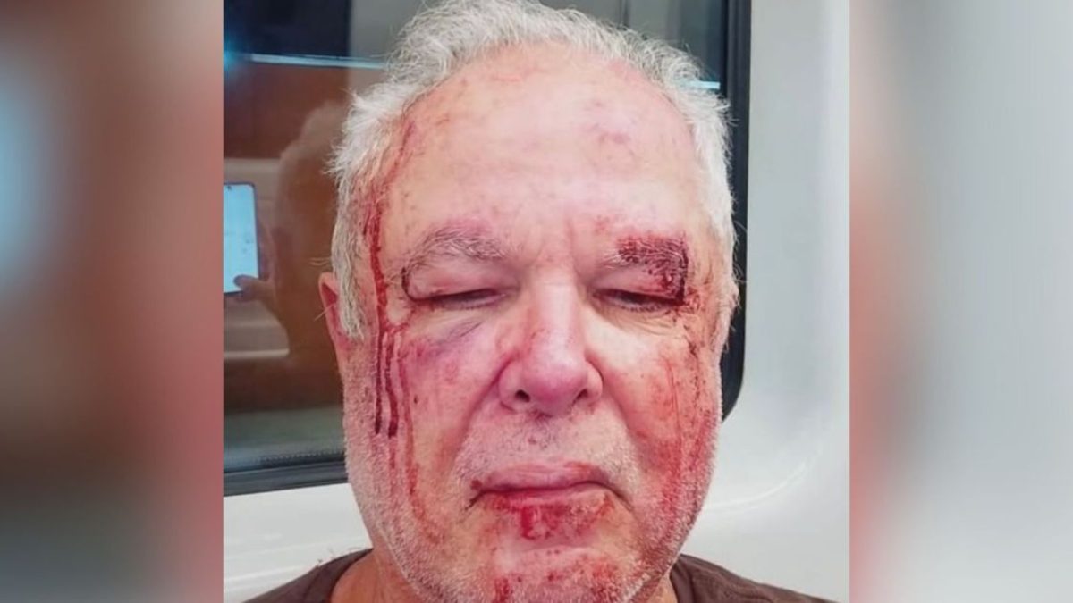 Idoso é agredido em Copacabana por usar adesivo de deputada do PT; polícia investiga