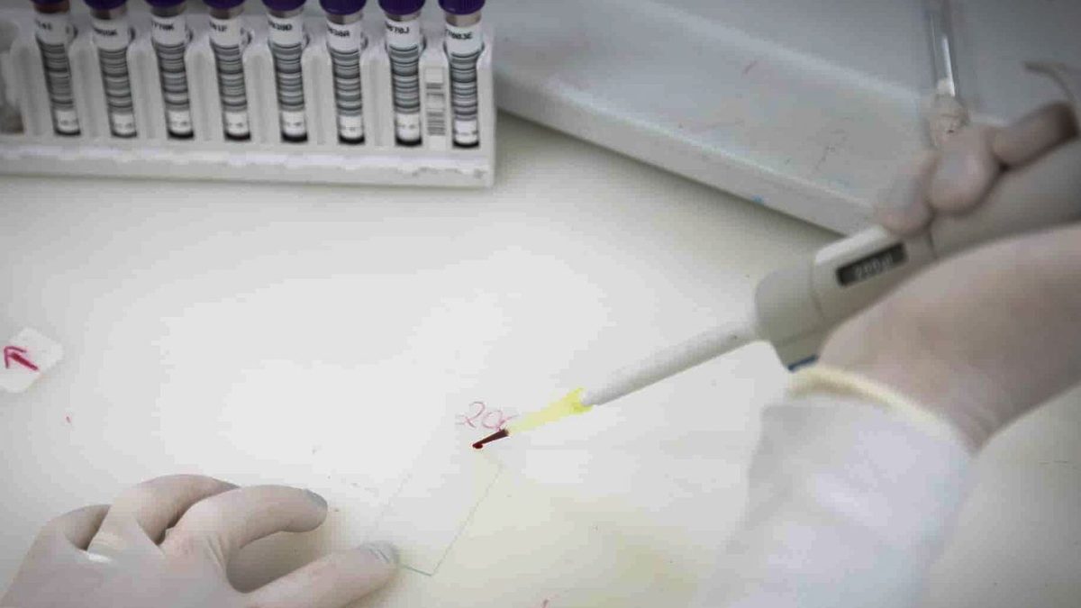 SP investiga novo caso suspeito de ebola em mulher que voltou do Congo