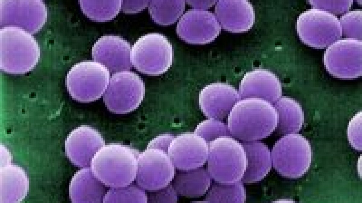Especialistas da Unifesp alertam para aumento de tuberculose após pandemia e apontam desigualdade social como causa