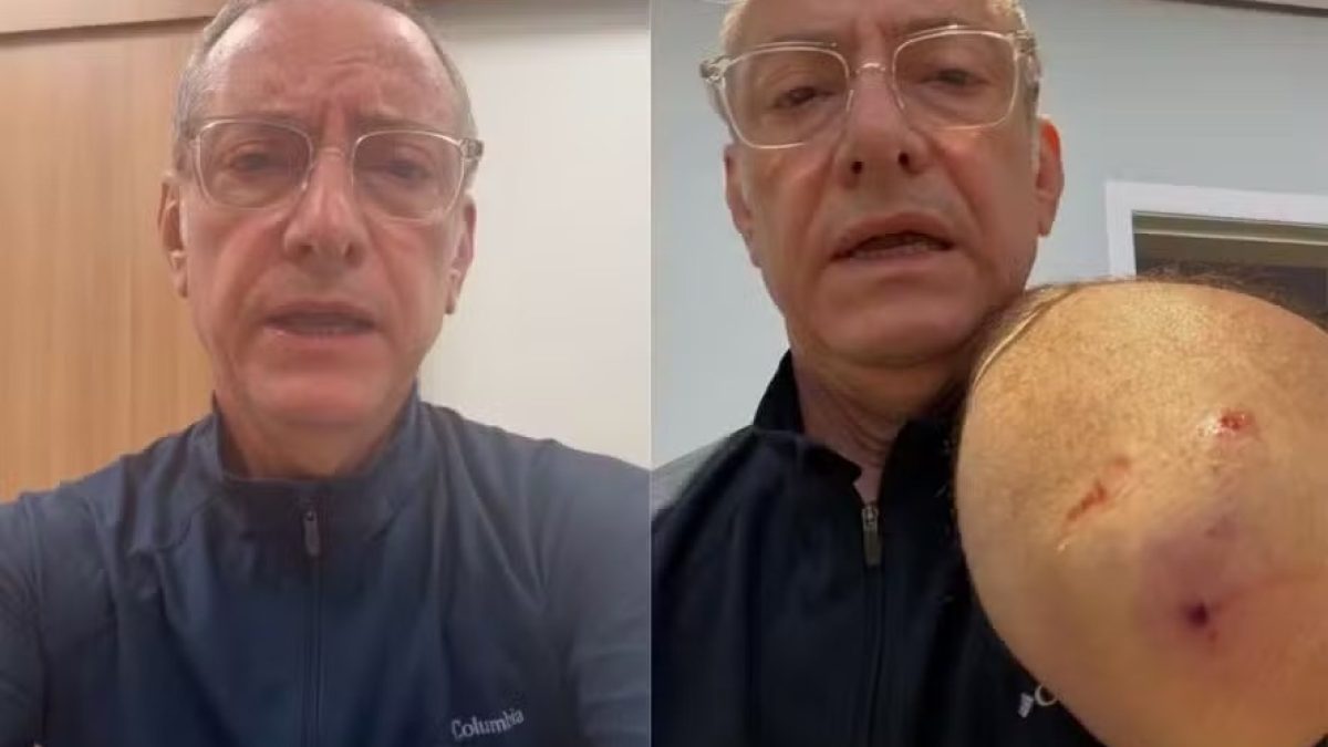 Apresentador da Globo é atacado por pitbull e pede mais responsabilidade a donos