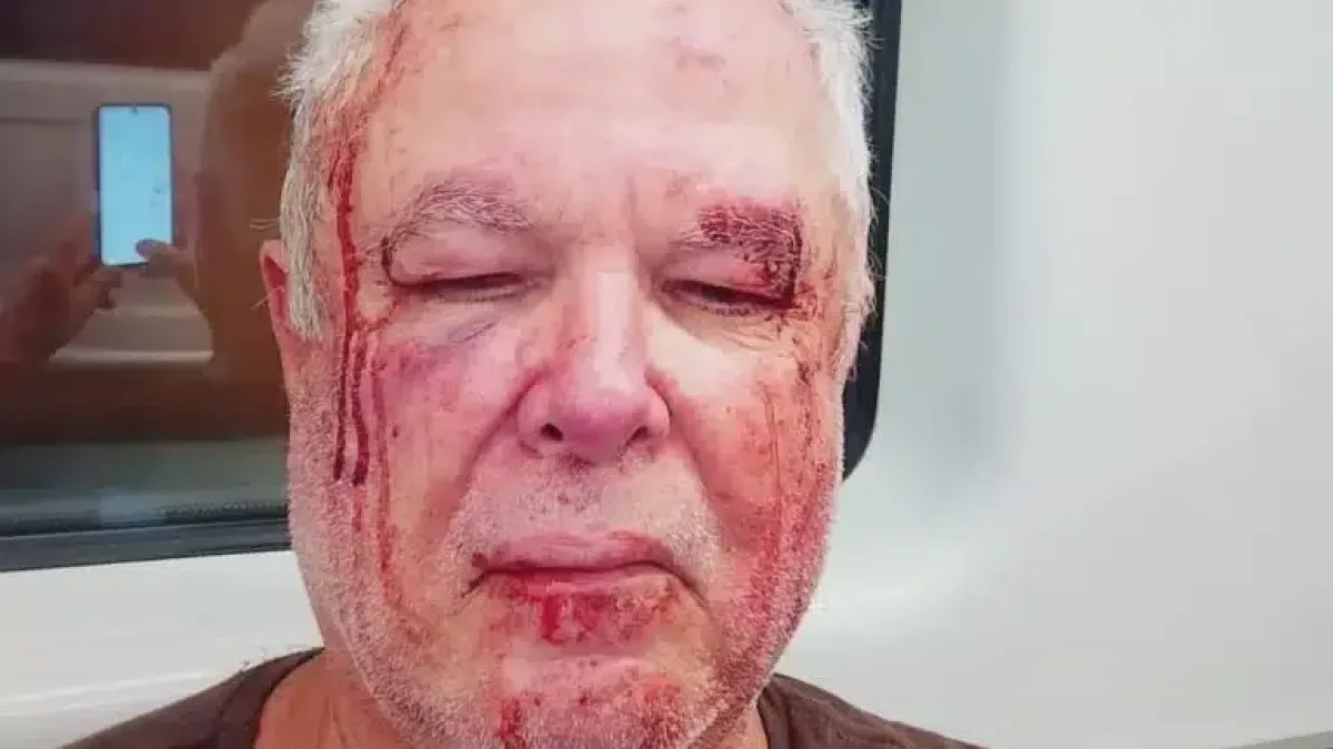 Eleitor do PT é espancado no Rio e relata tentativa de homicídio com motivação política