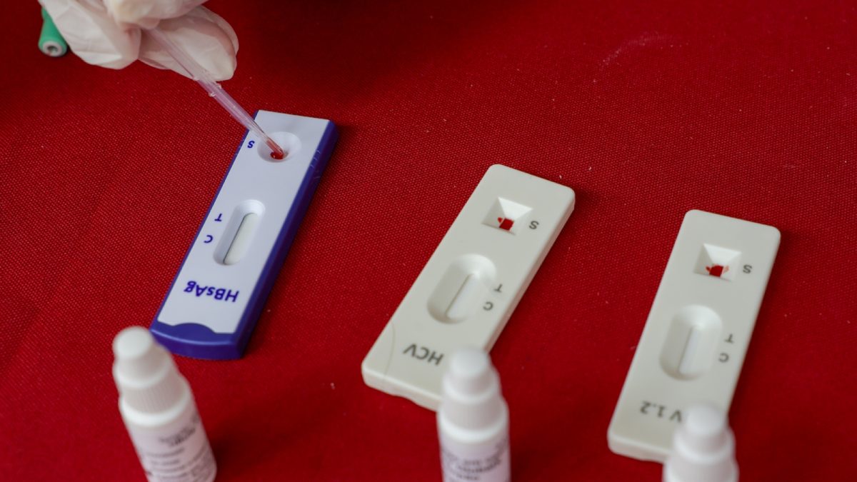 ONU: cortes de Trump ameaçam décadas de avanços contra HIV