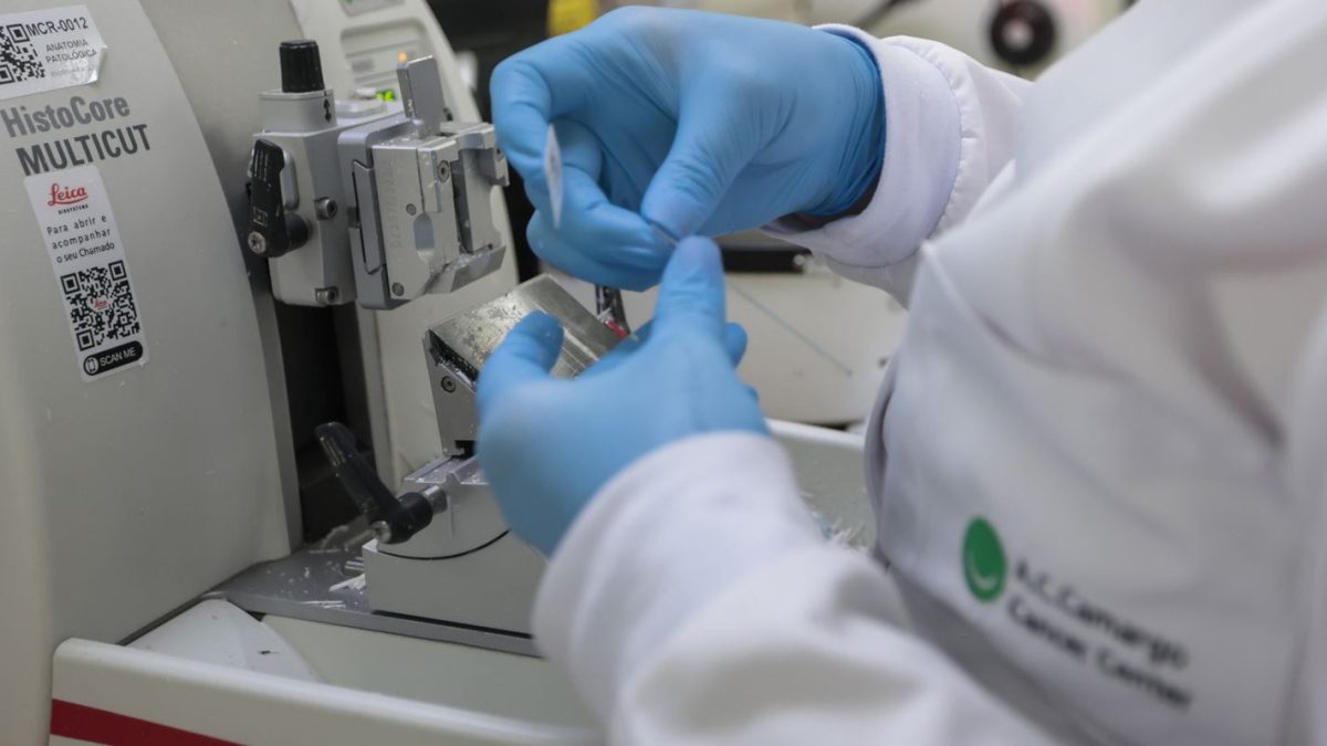 SUS passa a oferecer terapia combinada para leucemia mieloide aguda em adultos