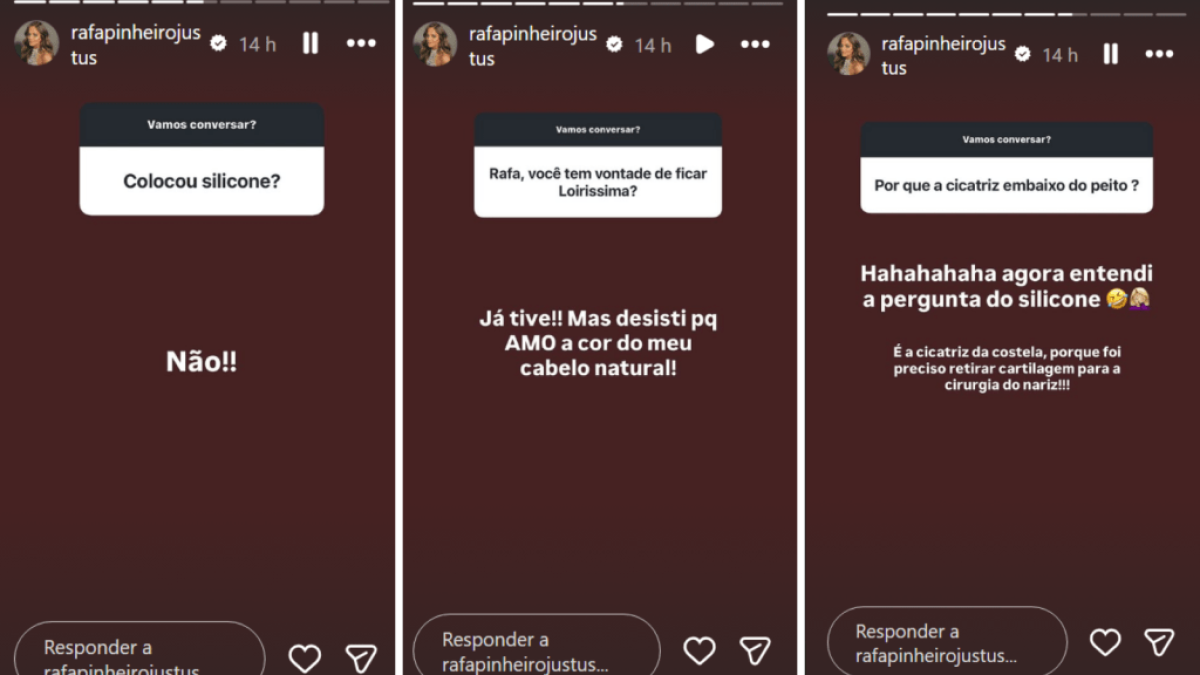 Rafa Justus explica cicatriz e revela que desistiu de mudança no visual