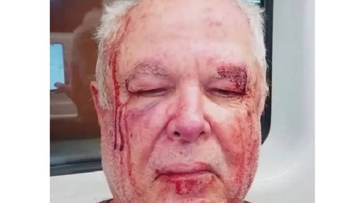 Idoso agredido no Rio após usar adesivo do PT relata tentativa de homicídio